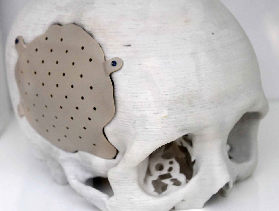 �@������ɫ�ĸ�ˎ��������Ŀ��������3D��ӡ���XĤ��